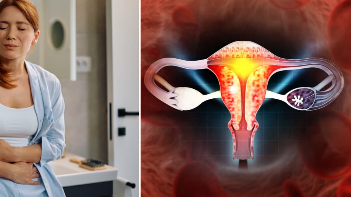 Hinchazón persistente: la señal de alerta que muchas mujeres ignoran y podría ser cáncer de ovario