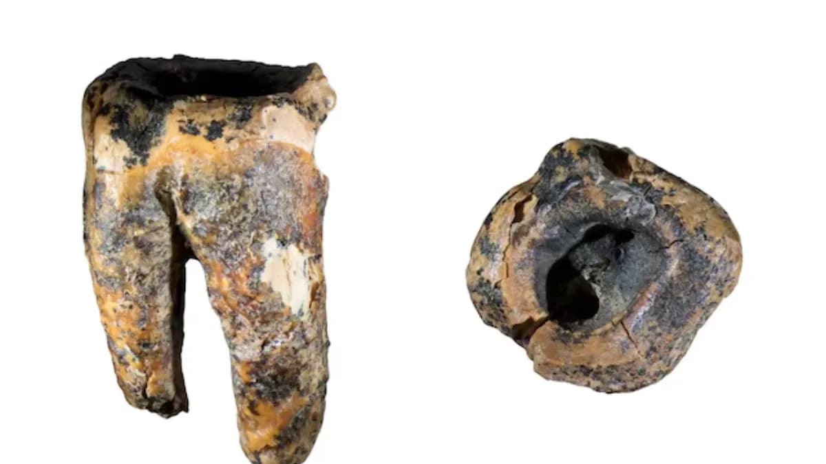 Neandertales perforaban dientes con herramientas de piedra hace 59.000 años para tratar infecciones
