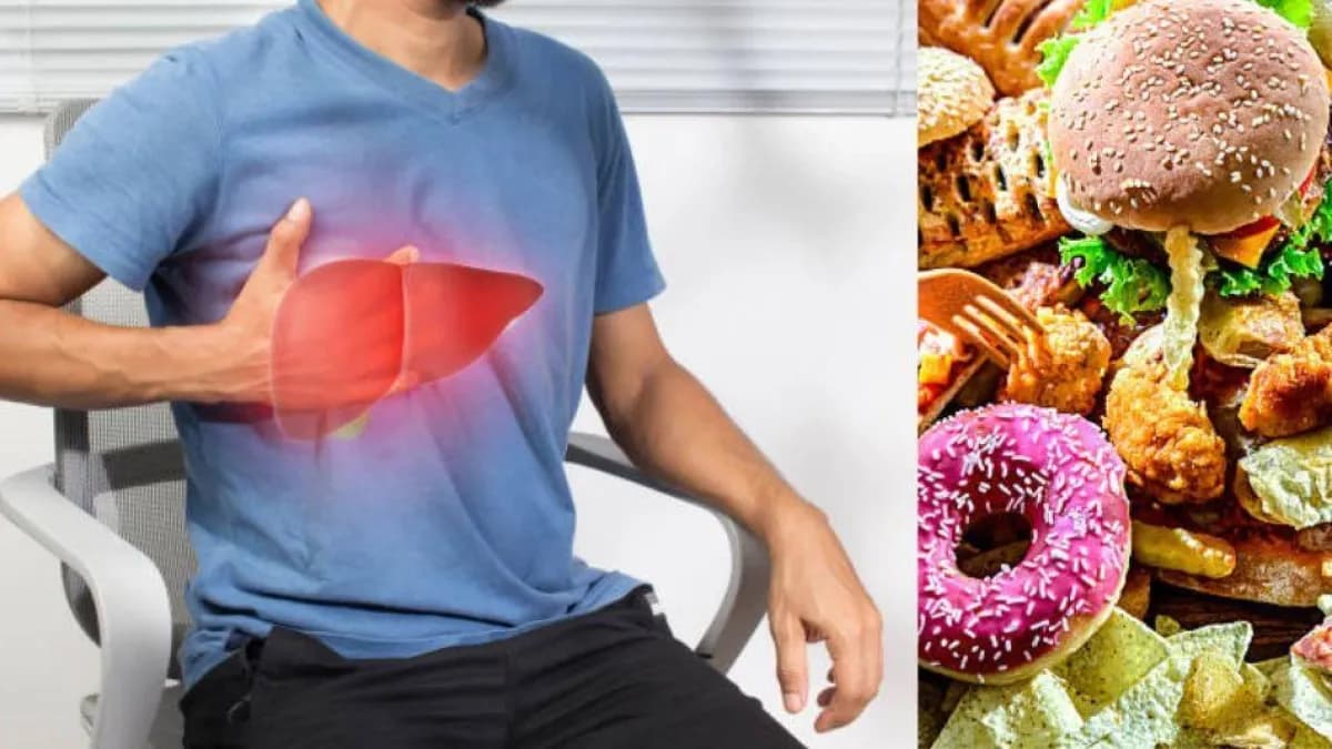Hígado graso: los alimentos ultraprocesados que acelera el daño a tu hígado
