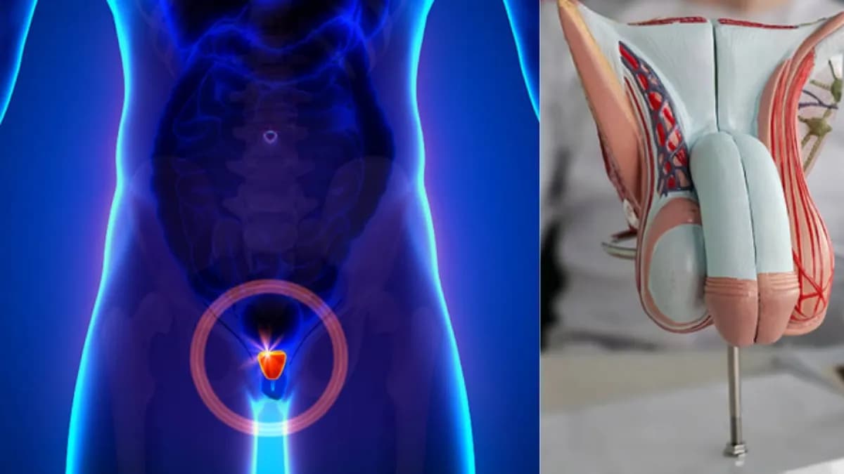 Cáncer de próstata: por qué no debes esperar síntomas para hacerte revisar