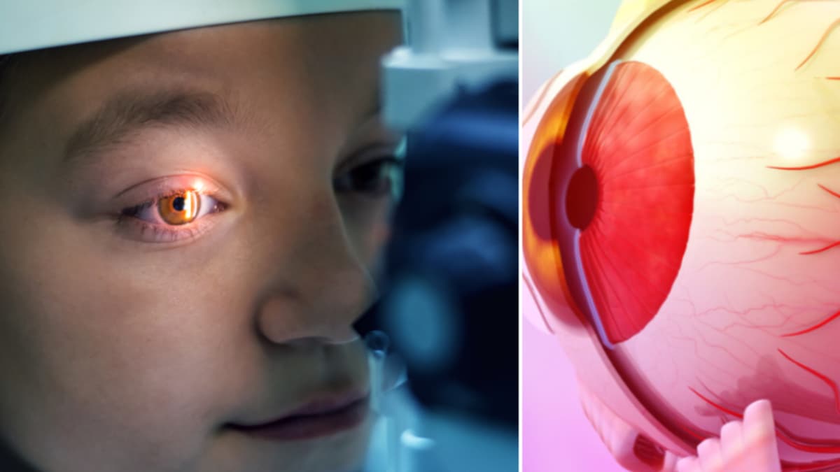 Moscas volantes en los ojos: cuándo son normales y cuándo debe alarmarse y consultar