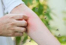 Córdoba en alerta: más de 2.500 casos de dengue y malaria en lo que va del año