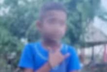 Niño de 8 años reingresa a hospital tras complicación en herida de cirugía en la cabeza