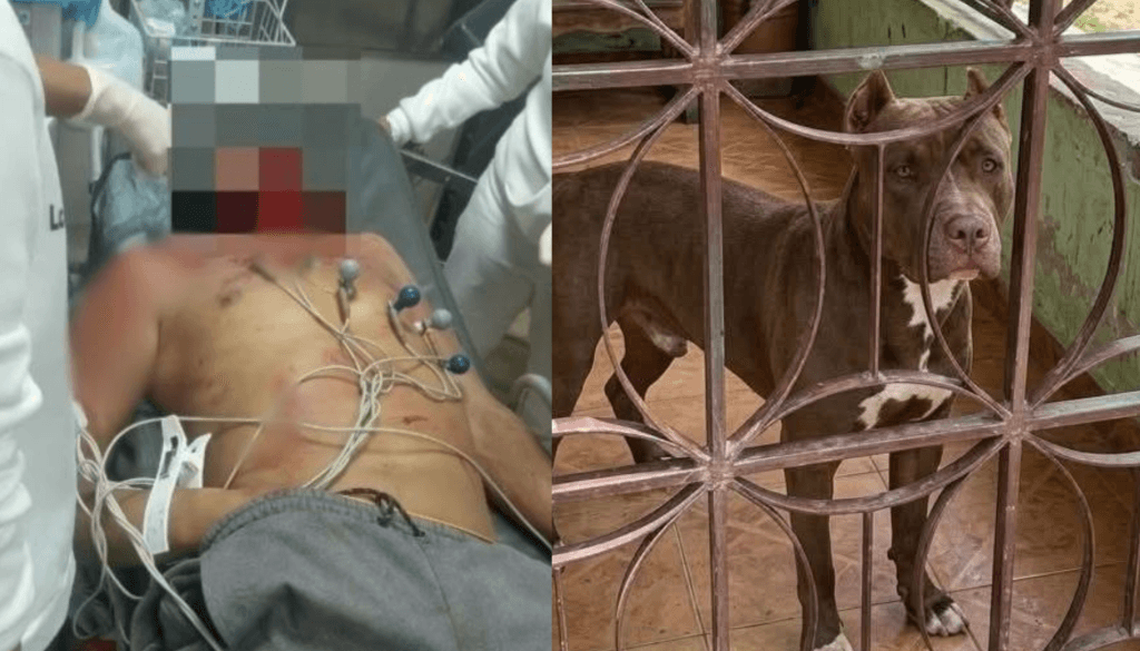 Hombre muere desangrado tras ser atacado por su propio pitbull en Las Corinas